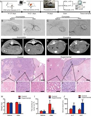 Intravoxel incoherent motion imaging used to assess tumor microvascular changes after transarterial chemoembolization in a rabbit VX2 liver tumor model